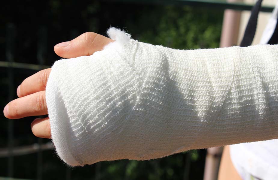 Gebroken hand door letselschade